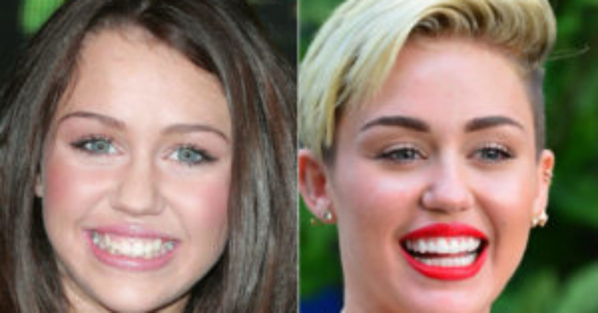 Miley-Cyrus-teeth-300x200 Miley-Cyrus-teeth-300x200